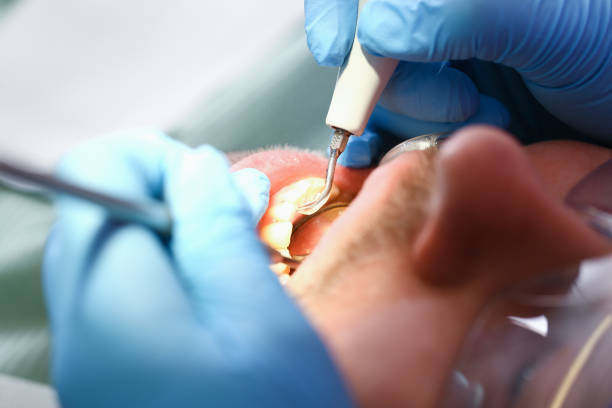 Best Pediatric Emergency Dentist in Merritt Island, FL